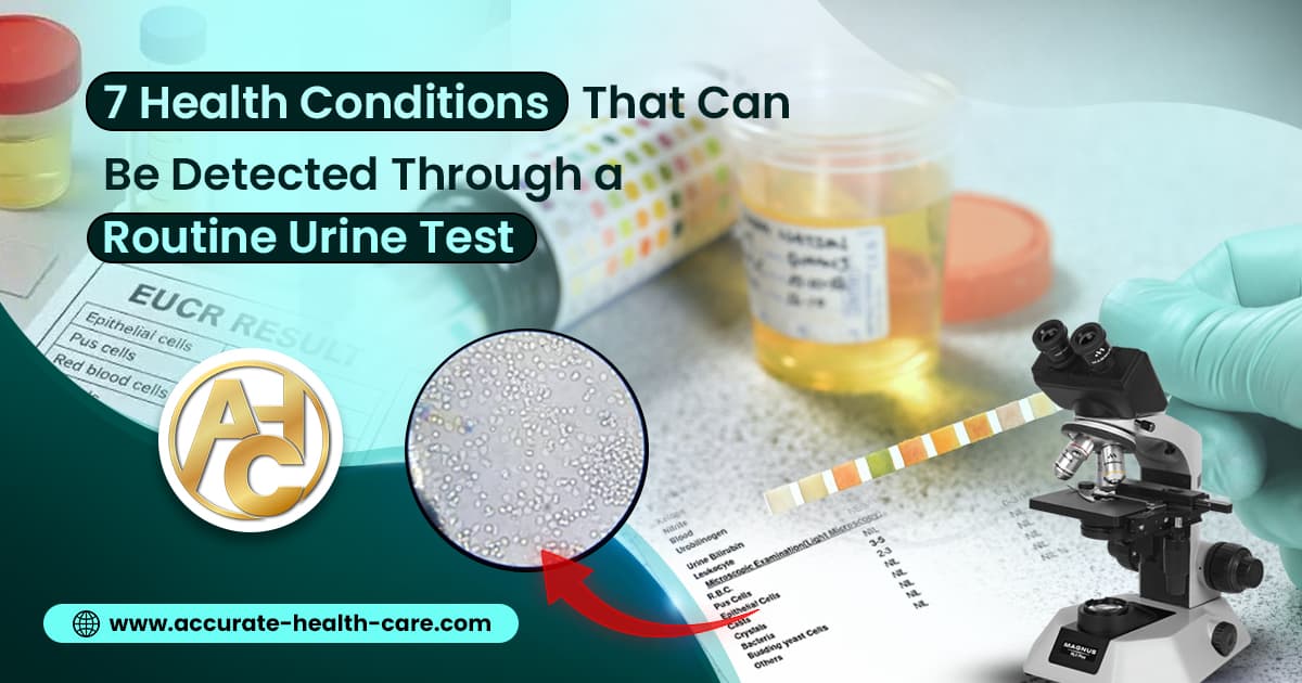 7 Health Conditions That Can Be Detected Through a Routine Urine Test