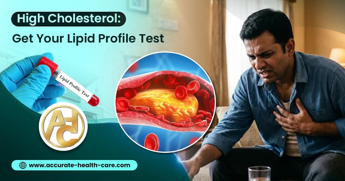 High Cholesterol Has No Symptoms: Why You Need a Lipid Profile Test Before It's Too Late