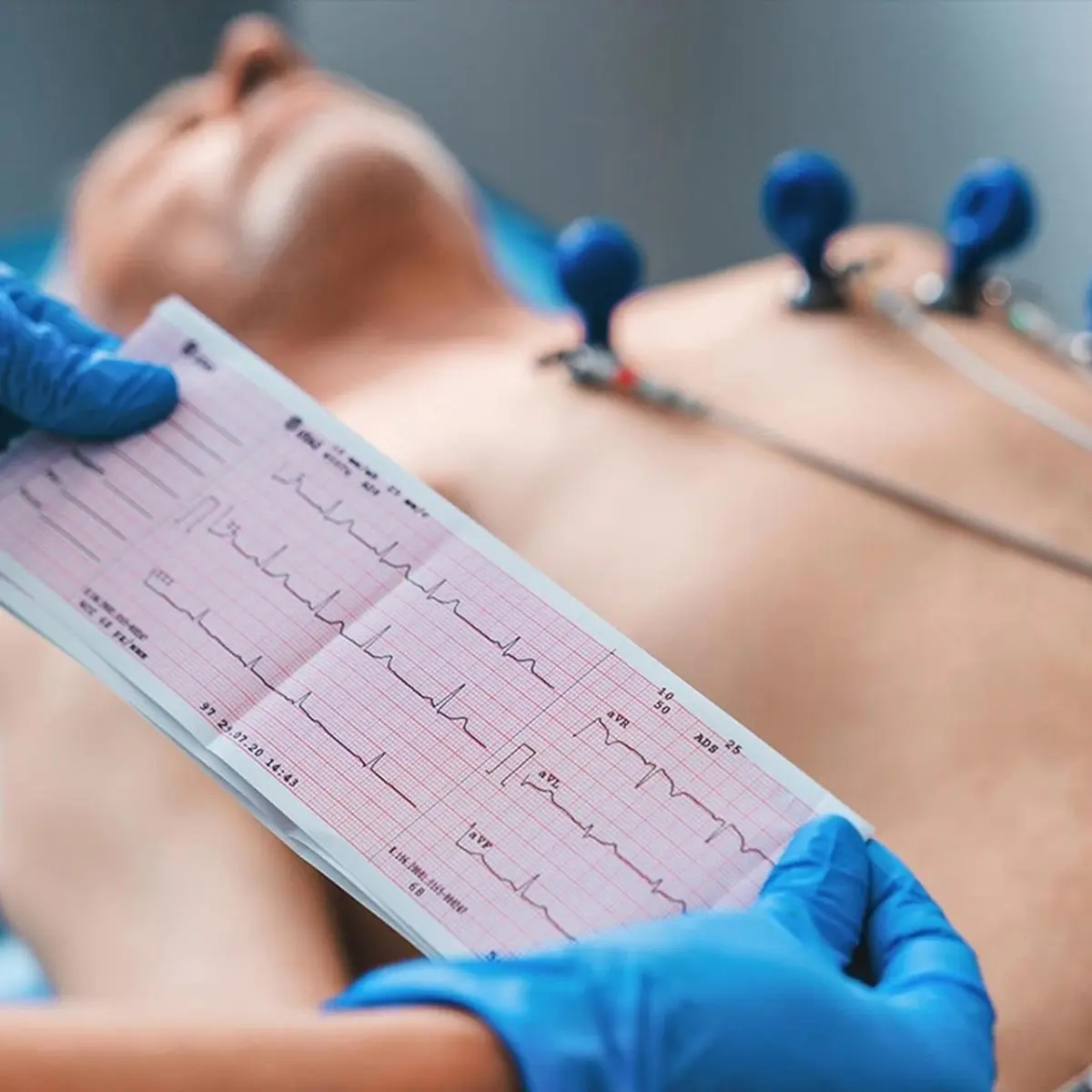Diagnostic Tests